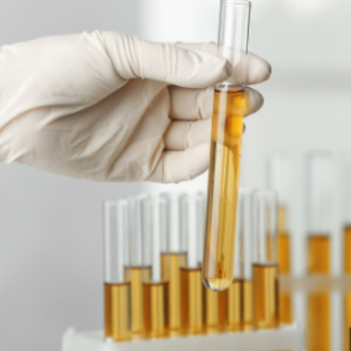 Organic Acids Test (OAT)