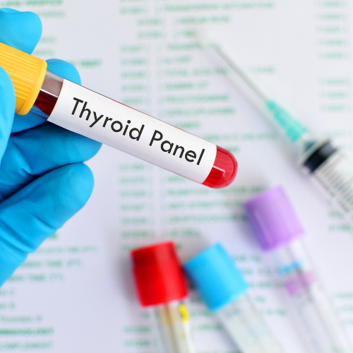 Full Thyroid Panel